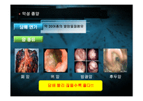 흡연과 건강관리-14