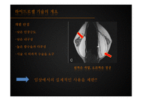 [생체소재화학] 하이드로젤을 이용한 약물전달-5