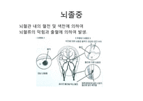 뇌기능 노화에 따라 발생하는 증상과 영양관리-6