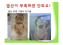 산모와 식생활 레포트-16