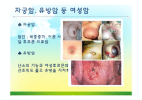[보건교육] 갱년기 여성을 위한 건강교육 계획안-19