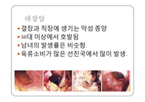 대장암 레포트-3