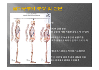 골다공증의 이해-7