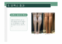 [약과건강] 보톡스의 허와 실-15