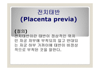 산과적 응급 상황 및 처치-2