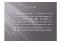 두부손상 및 뇌손상시 응급처치-13