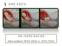 [미국정치 경제론] 미국의 낙태문제와 헌법 및 한국의 현황-4