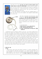 epilepsyseizure간질환자의간호-8