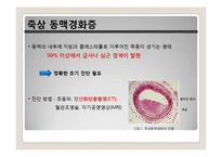 요오드가 함유된 나노 리포좀 조영제의 합성방법에 관한 연구-3