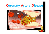 [건강과 간호] 관질환(Coronary Artery Disease) PBL-5