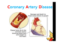 [건강과 간호] 관질환(Coronary Artery Disease) PBL-6