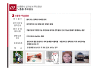 뇌졸중의 치료와 예방-12
