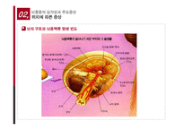 뇌졸중의 치료와 예방-13