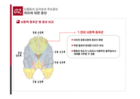 뇌졸중의 치료와 예방-14