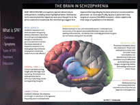 정신분열증(Schizophrenia)증상과 치료(영문)-9
