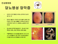 당뇨 길라잡이 레포트-19