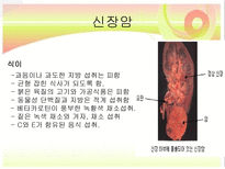 신장질환 및 신장의 식이요법-10