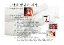 여성과 낙태 레포트-3
