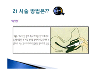 [생명윤리] 인공수정-5