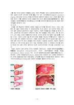 간암 간호과정 레포트-3