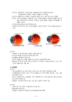 당뇨합병증 간호과정-8