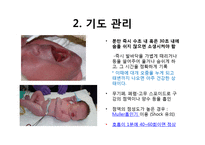 [아동간호학] 신생아 간호 실습-4