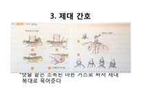 [아동간호학] 신생아 간호 실습-6