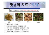 현대인의 음식보감-홧병에 대하여(원인, 증상, 치료법 및 자가진단법)-7