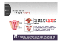 [성 심리] 성 기관 질환-9