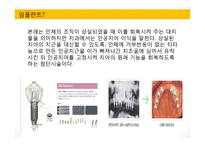 [마케팅 전략] 마이클 포터 산업구조 분석-4