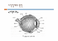 [특수교육] 시각, 청각 장애아의 이해-7