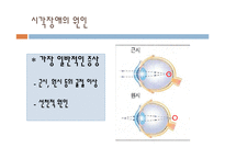 [특수교육] 시각, 청각 장애아의 이해-8