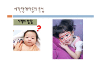 [특수교육] 시각, 청각 장애아의 이해-11