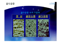 [영양학개론] 콜라겐과 골다공증-9