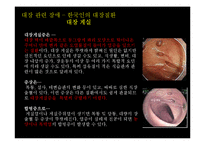 [성인간호] 한국인의 소화기계 문제 특성-14