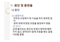 [아동 교육] 특수 아동의 이해-시각장애아동의 특성과 지도-12