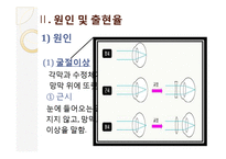 [아동 교육] 특수 아동의 이해-시각장애아동의 특성과 지도-13