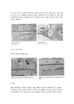 (미술치료) 풍경구성법-5
