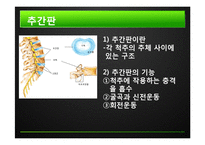 추간판탈출증 레포트-2