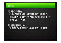 추간판탈출증 레포트-9