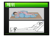 추간판탈출증 레포트-17