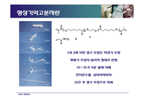 [고분자공학] 형상기억 어린이 칫솔 모 제품 설계안-18