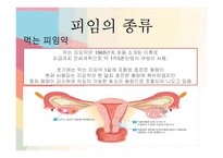 [성심리와 성건강] 피임의 중요성과 올바른 피임교육-10