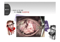 [성과 심리] 성 기관 질환 종류와 예방-8