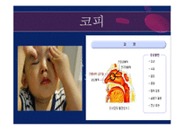[아동간호학] 영유아 외상 종류와 치료 및 예방법-8
