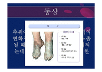 [아동간호학] 영유아 외상 종류와 치료 및 예방법-11