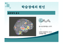 [특수교육] 학습부진 및 학습장애-7