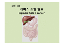 [일반외과] 결장암(sigmoid colon cancer) 사례-1