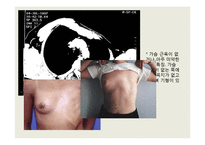 [병리학] 순환장애 희귀병-20