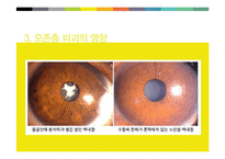 온존층에 대한 이해와 파괴의 원인과 대응방안-7